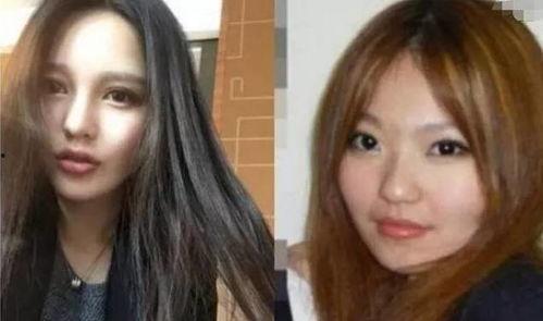 网红惠子整容前,整容前后的惊人对比